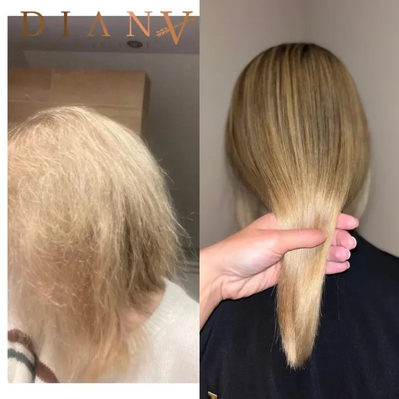 Pre-Nano HaarBotox  voor beschadigd haar herstel 500ml